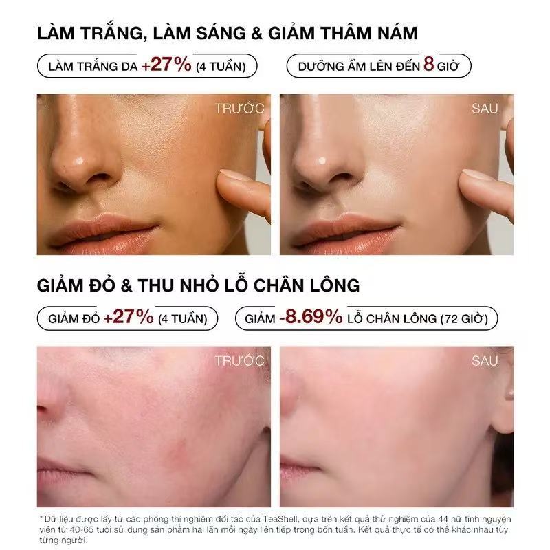 Skinoralabs Niacinamide Brightening Serum 5% before and after skin results